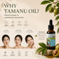 TREEANNSEA Madagascar Tamanu Olio originale 30ml 